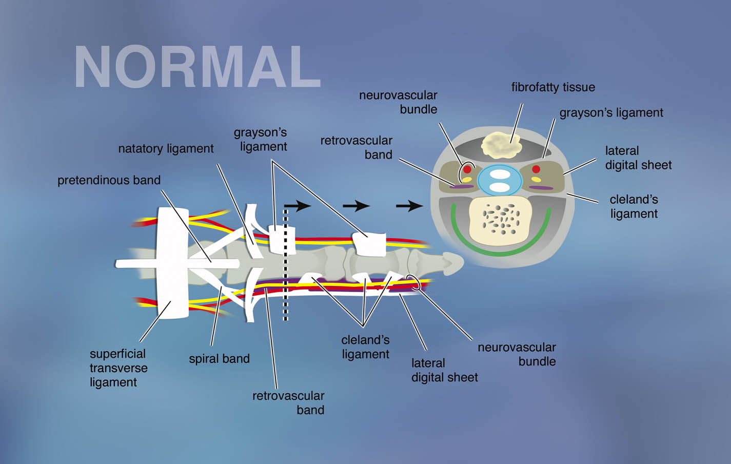 The normal retention pigments (fascial bands) that support the volar surface of the palm and digit with a cross sectional image of the digital fascial structures.