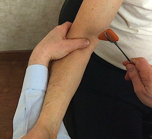 Biceps Reflex (C5) at right elbow