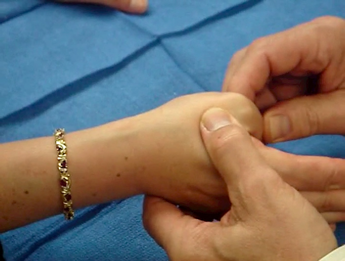 Alternative Finkelstein maneuver - The wrist is in neutral position while the thumb MP joint is maximally flexed. This pulls the EPB through the first extensor compartment and reproduces the patient's pain.