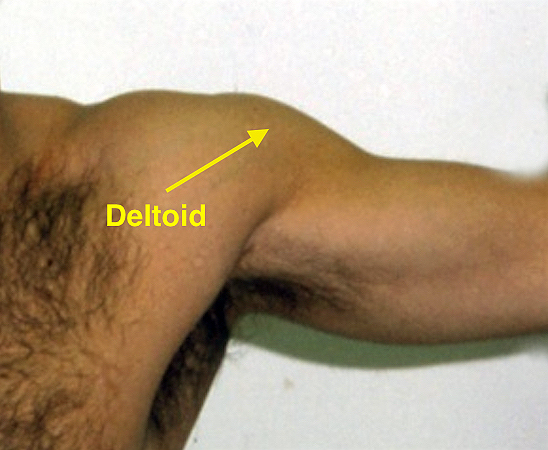 Deltoid muscle