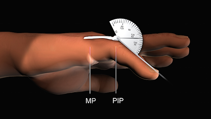 Measuring digital range of motion with goniometer