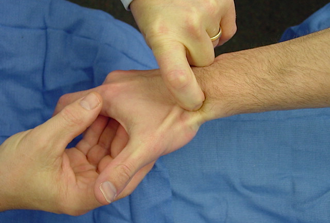 Palpation of scaphoid in anatomic snuff box 1