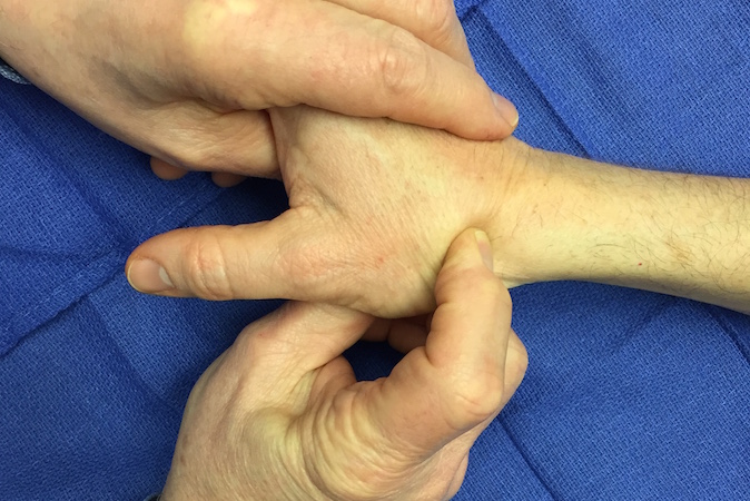 Palpation of scaphoid in anatomic snuff box 2