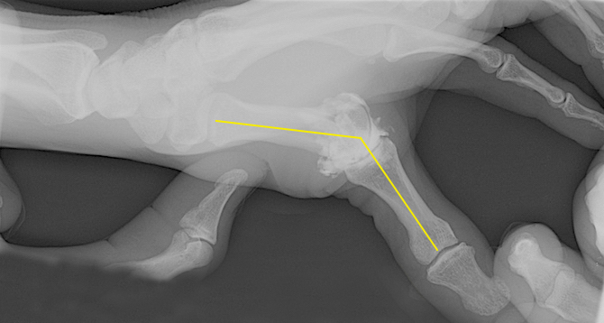 Stress X-ray - Ulnar Collateral of Thumb MP joint after arthrogram (Hover over right edge to see more images)