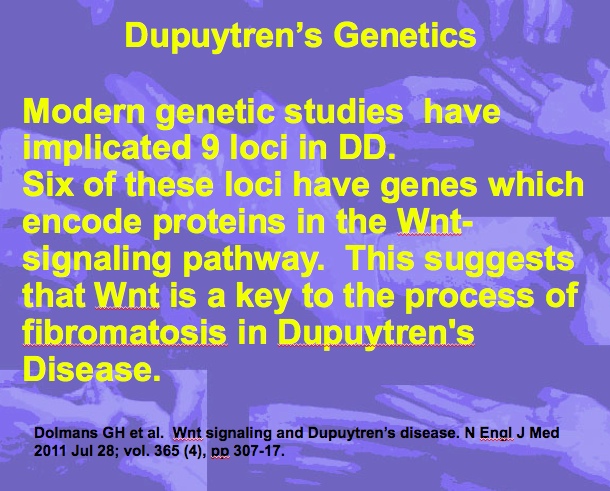 Dupuytren's Disease Basic Science