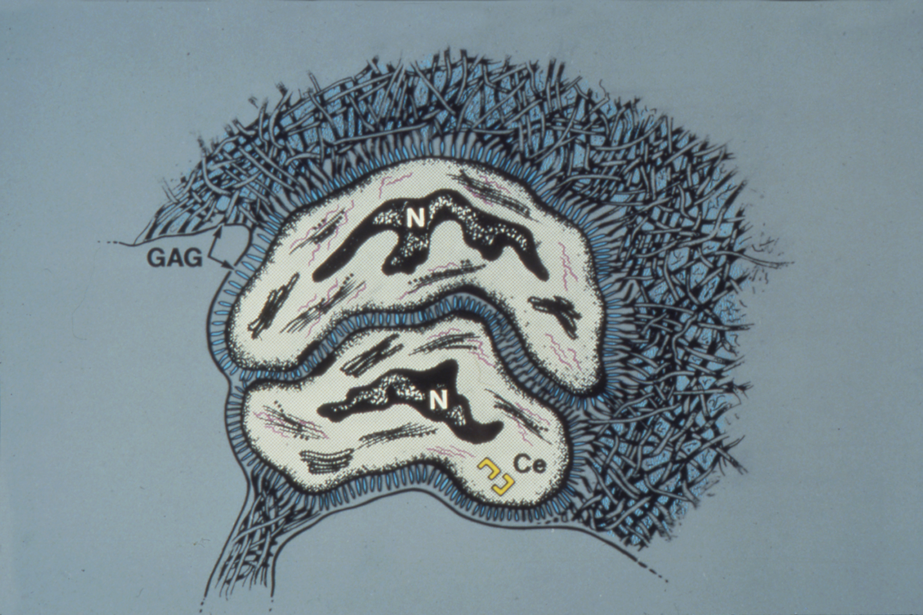 Dupuytren's Disease Basic Science